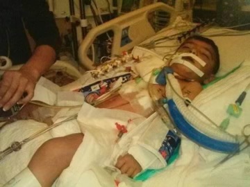 An infant with medical equipment on a hospital bed